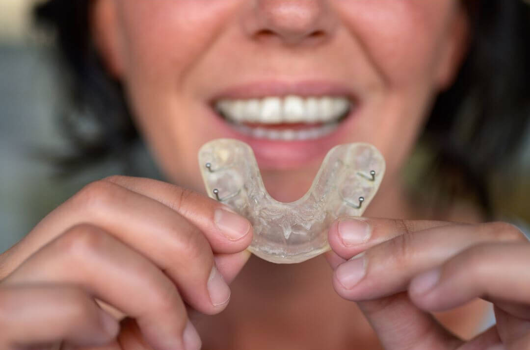 Férulas Dentales