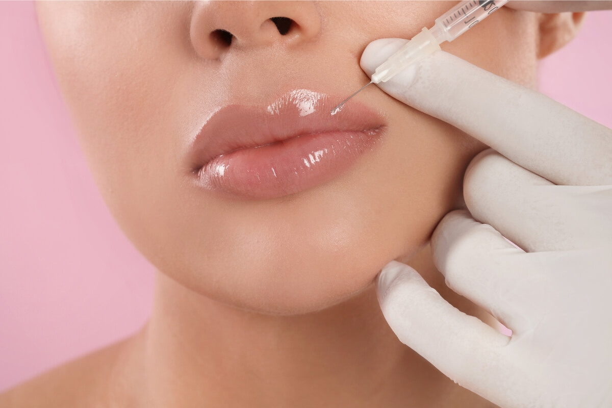 relleno de labios
