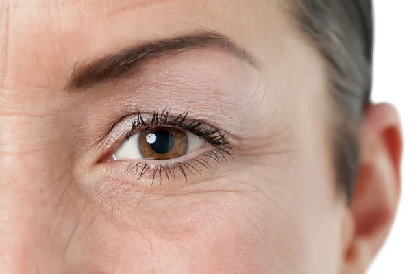 Arrugas debajo de los ojos
