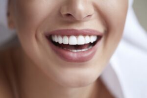 Diseño de sonrisa