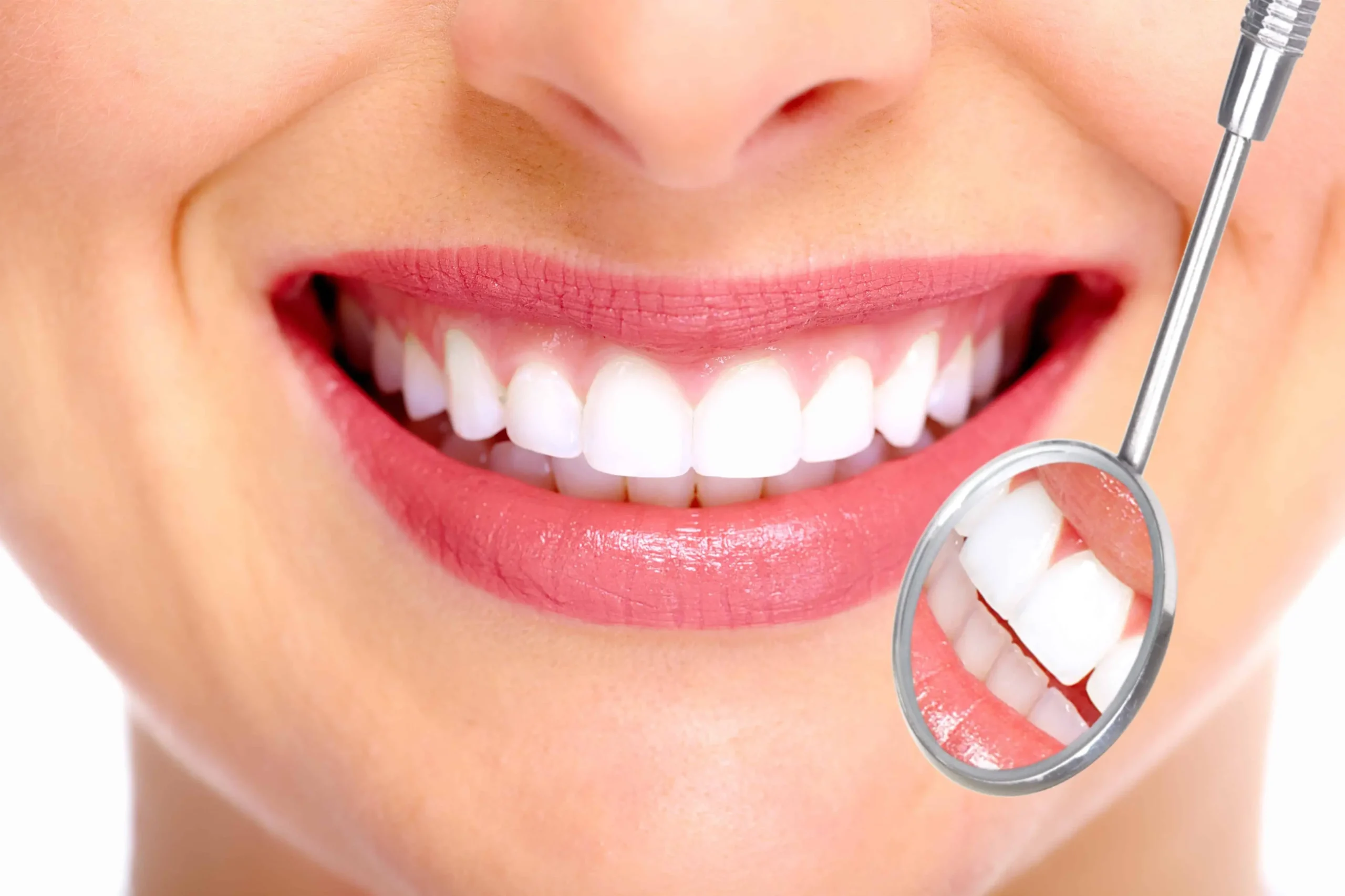 Diseño de sonrisa